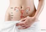 子宫后位对月经有影响吗？了解子宫后位对月经的影响