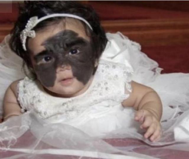 外国夫妇怕宝宝自卑戴上面具